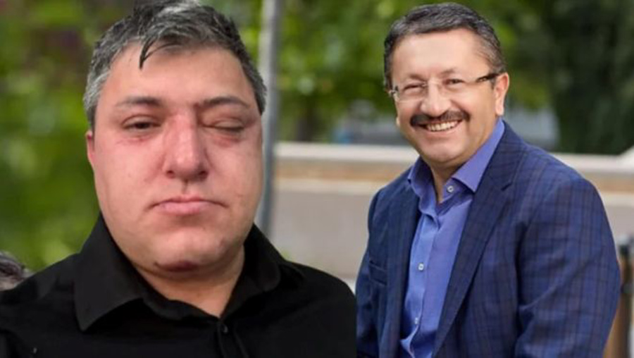 İddia: Belediye başkanı ve yardımcıları işçi dövdü