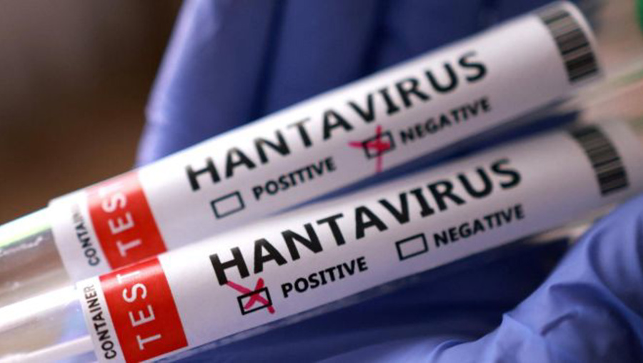 Türkiye'de hantavirüs riski var mı?